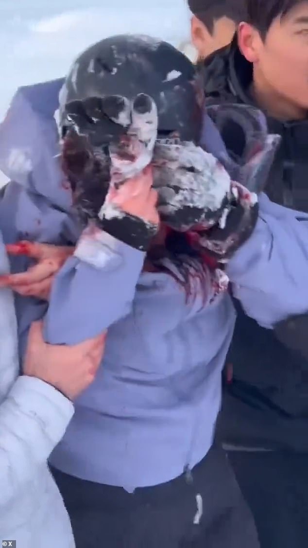 The woman was left seriously injured after the attack in the Talat village area of the Keketuohai UNESCO Global Geopark in Funyun County, northern China, at around 7pm on Friday