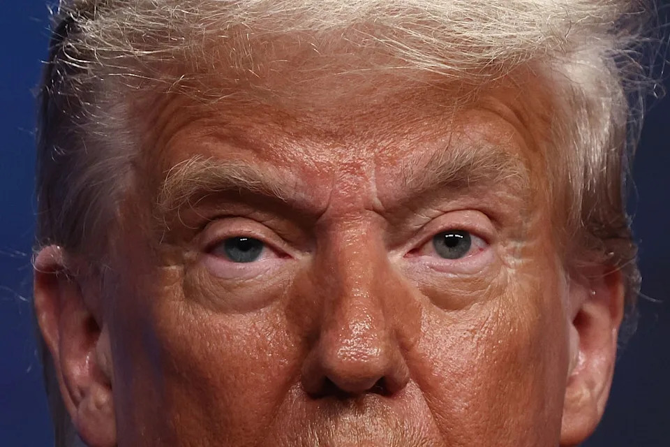 Close-up of a person's face showing eyes and forehead with visible expression lines