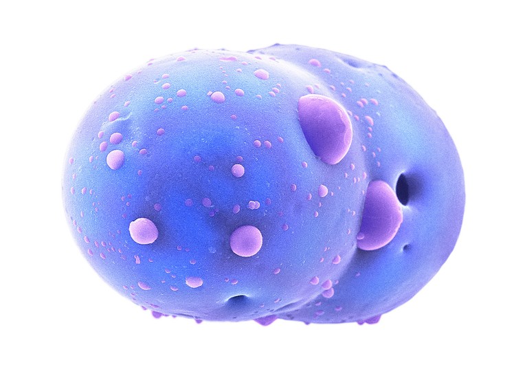 A coloured scanning electron micrograph of a pharmaceutical microsphere carrier for nanodrug particles.