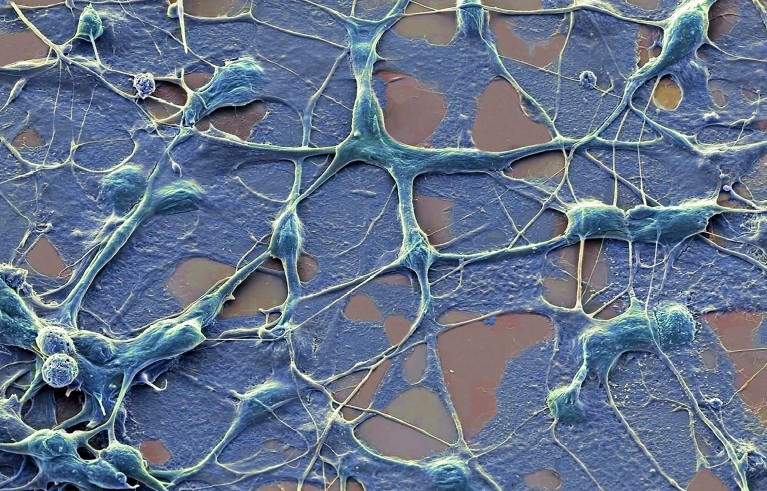 Coloured scanning electron micrograph of human nerve cells in blue on a grey background.