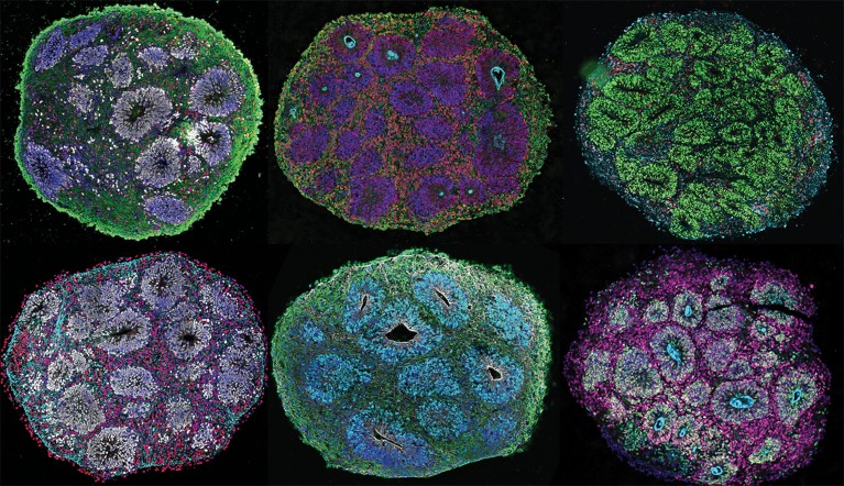 Collage of six brain organoids in green, blue, purple and lilac.
