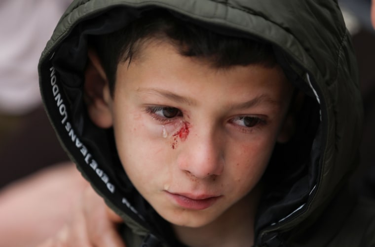 Mustafa Bani Odeh cries, an injury is seen below his eye