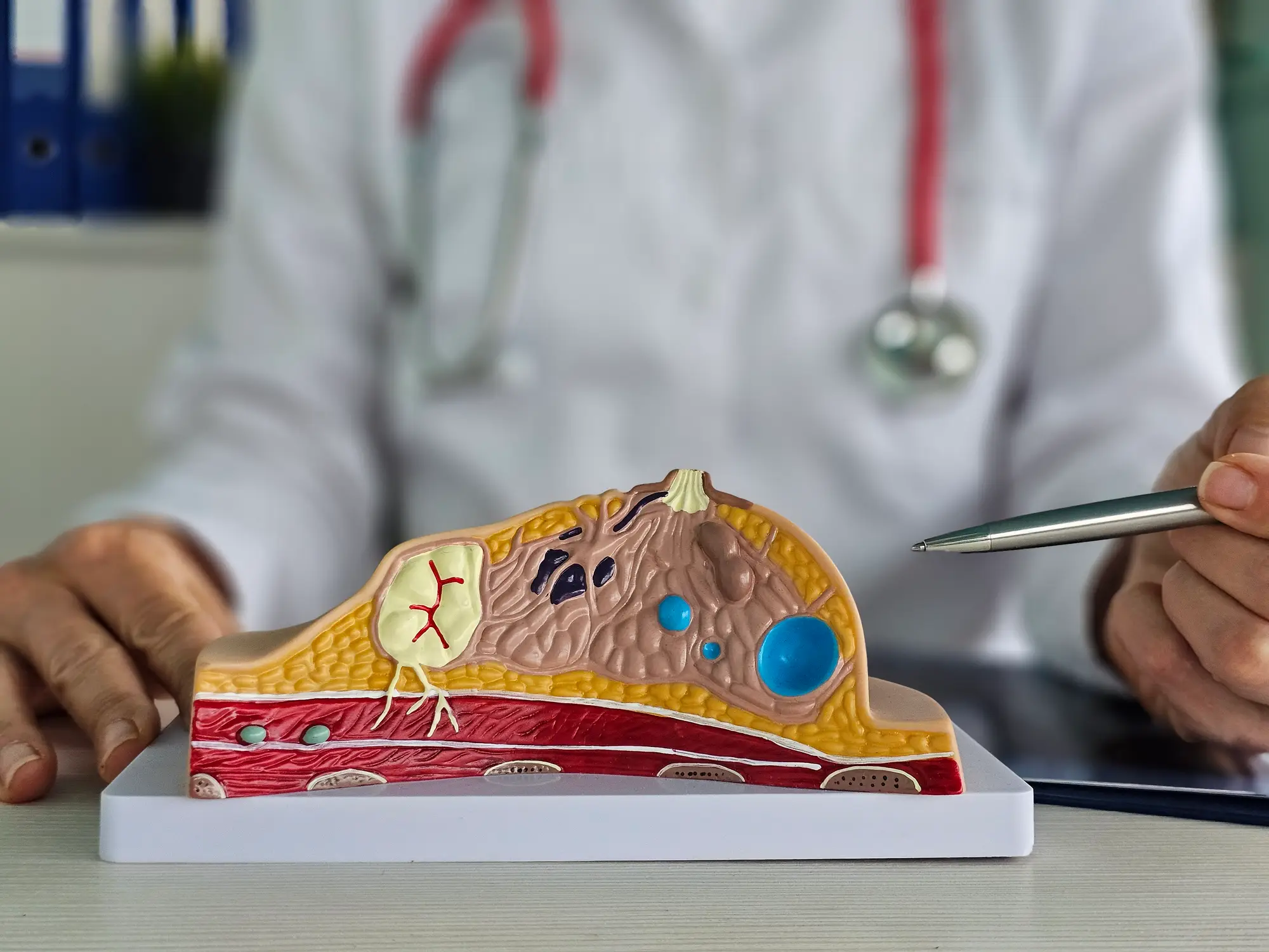 The rare condition affects the breasts (Getty Stock Images)